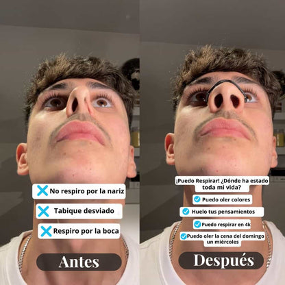 Parche nasal magnectico